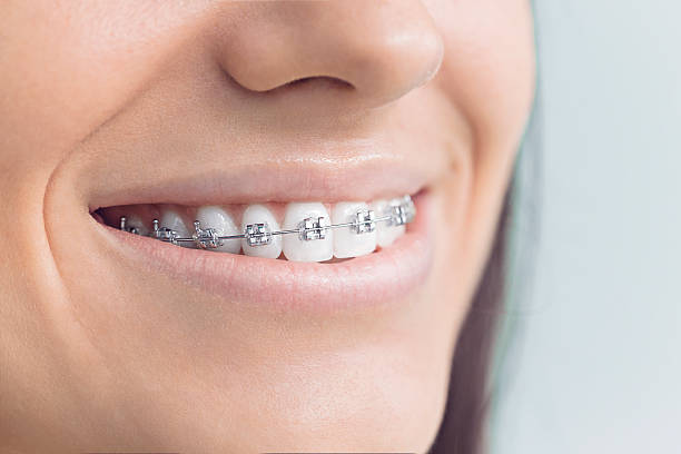Best Dental Fillings (Composite and Amalgam)  in Lumbine, CO